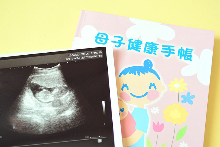 各時期に行う各種検査のイメージ画像