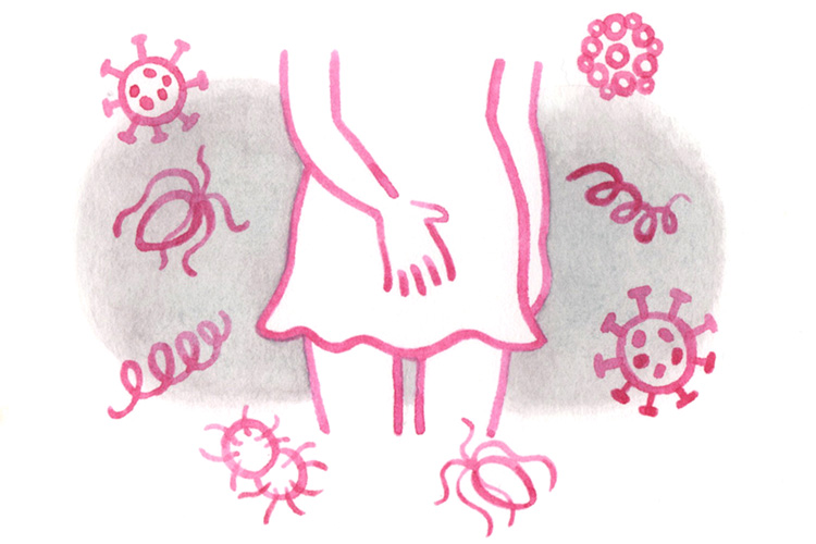 性感染症のイメージ画像